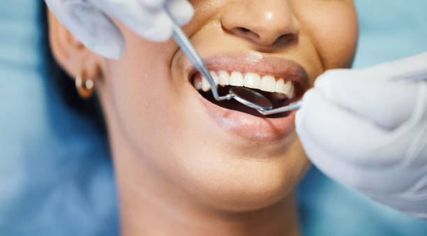 Best Holiday Emergency Dentist in Canton, MS